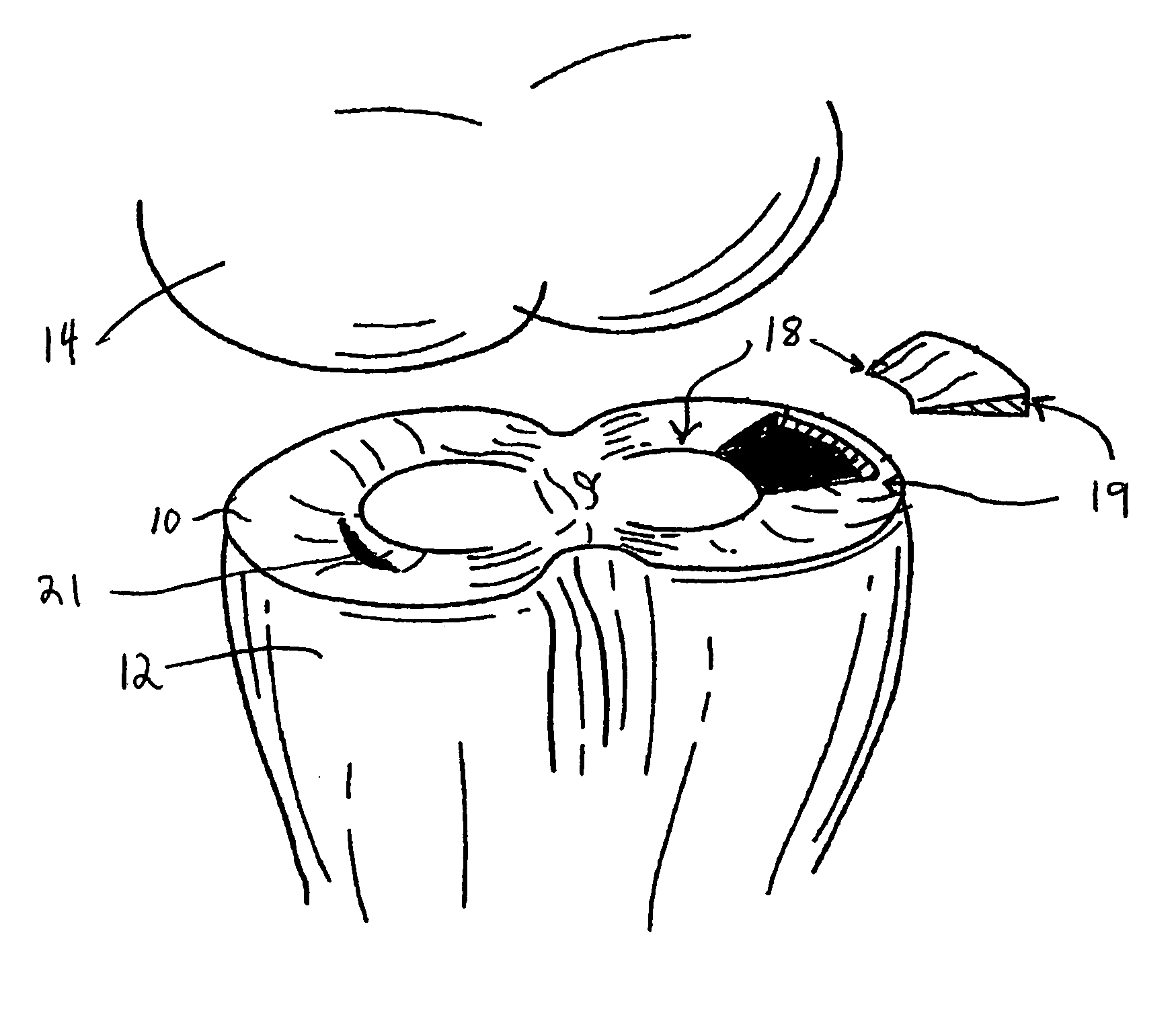 Meniscal repair scaffold