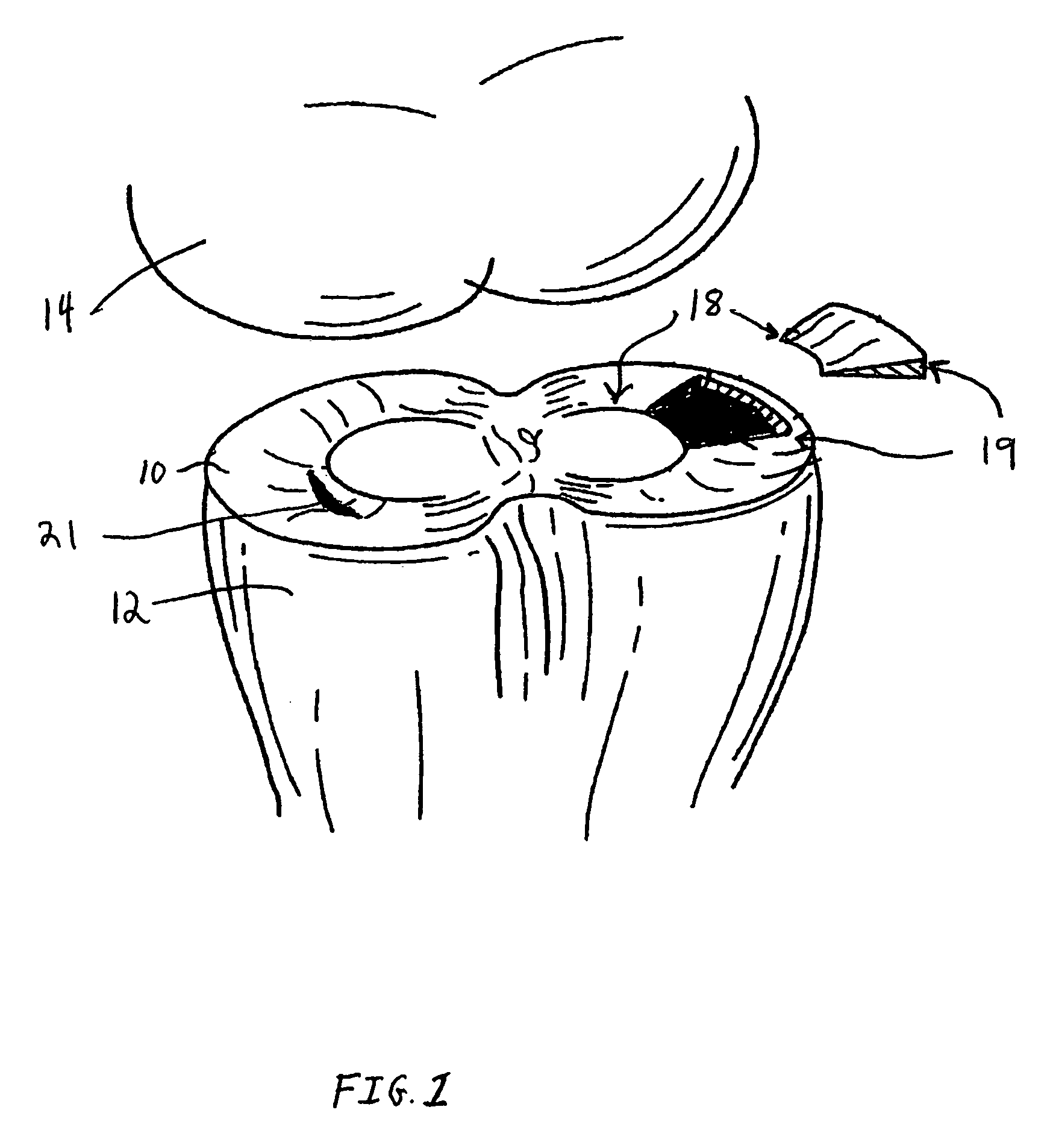 Meniscal repair scaffold