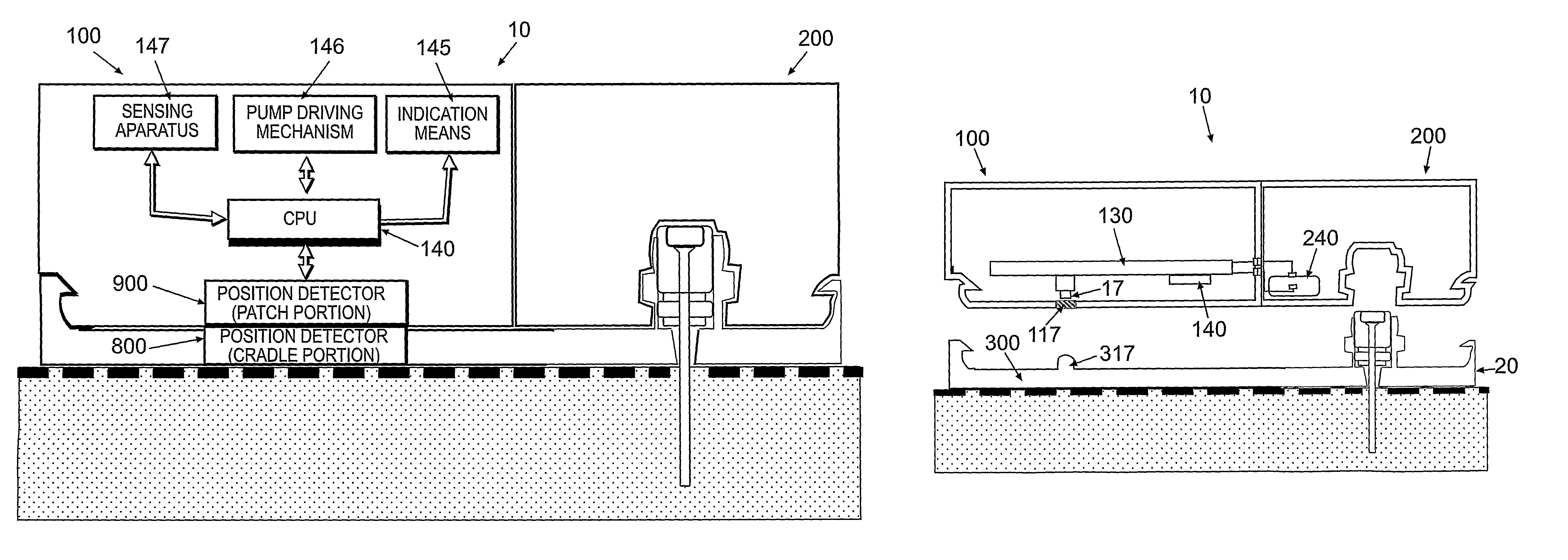 Detachable portable infusion device