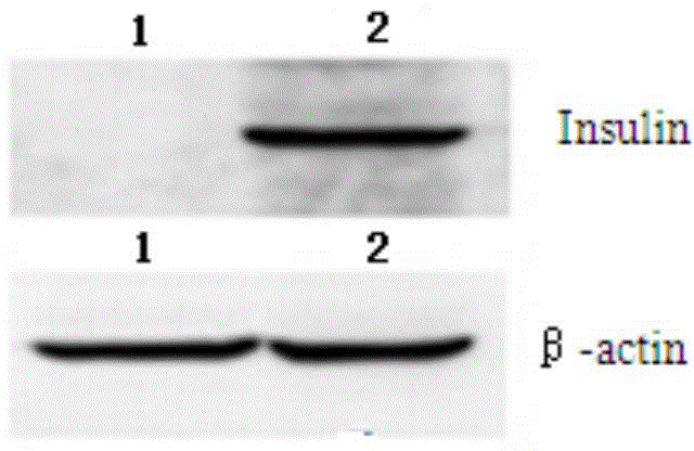 Human hematopoietic stem cell expressing human exogenous proinsulin and application thereof