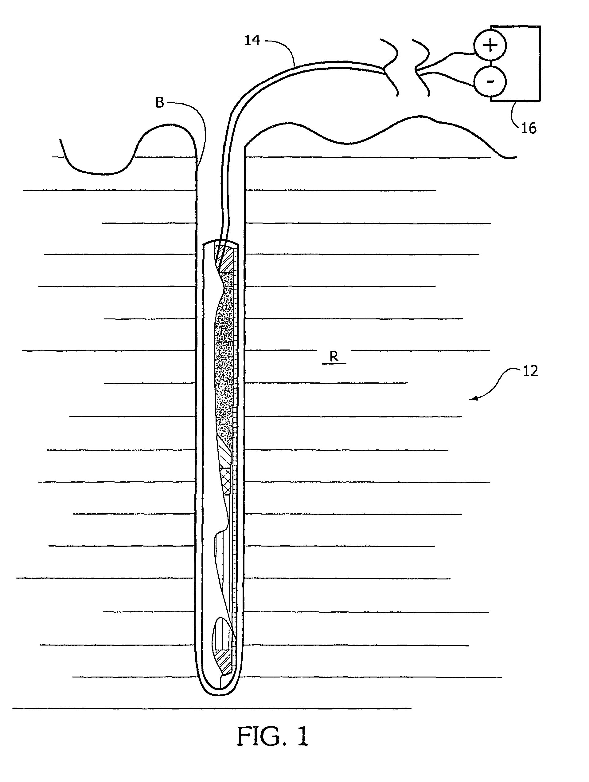 Self-stemming cartridge