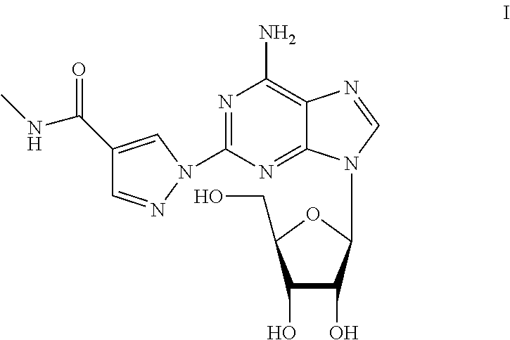 Process for the preparation of regadenoson