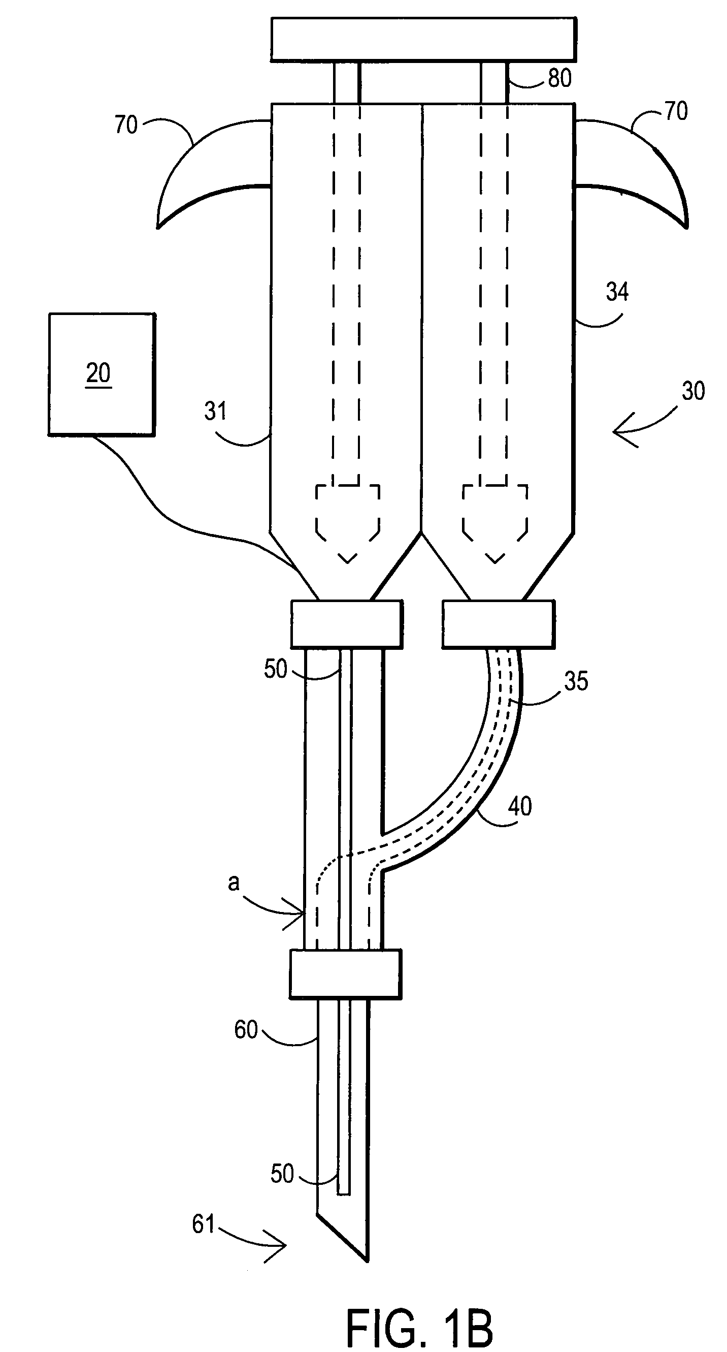 Method for repairing intervertebral discs