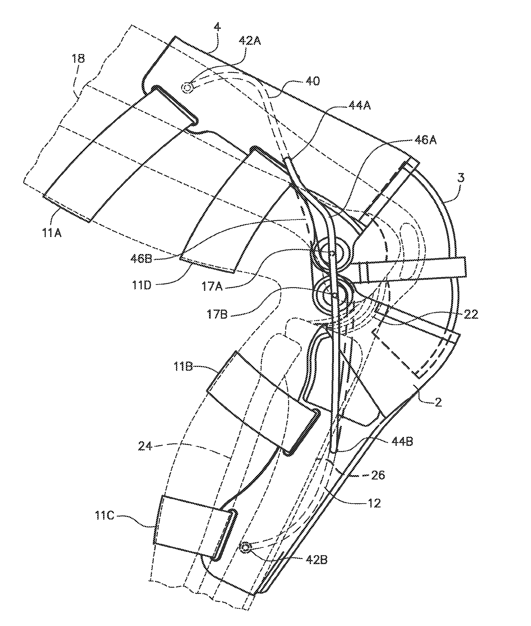 Cable knee brace system