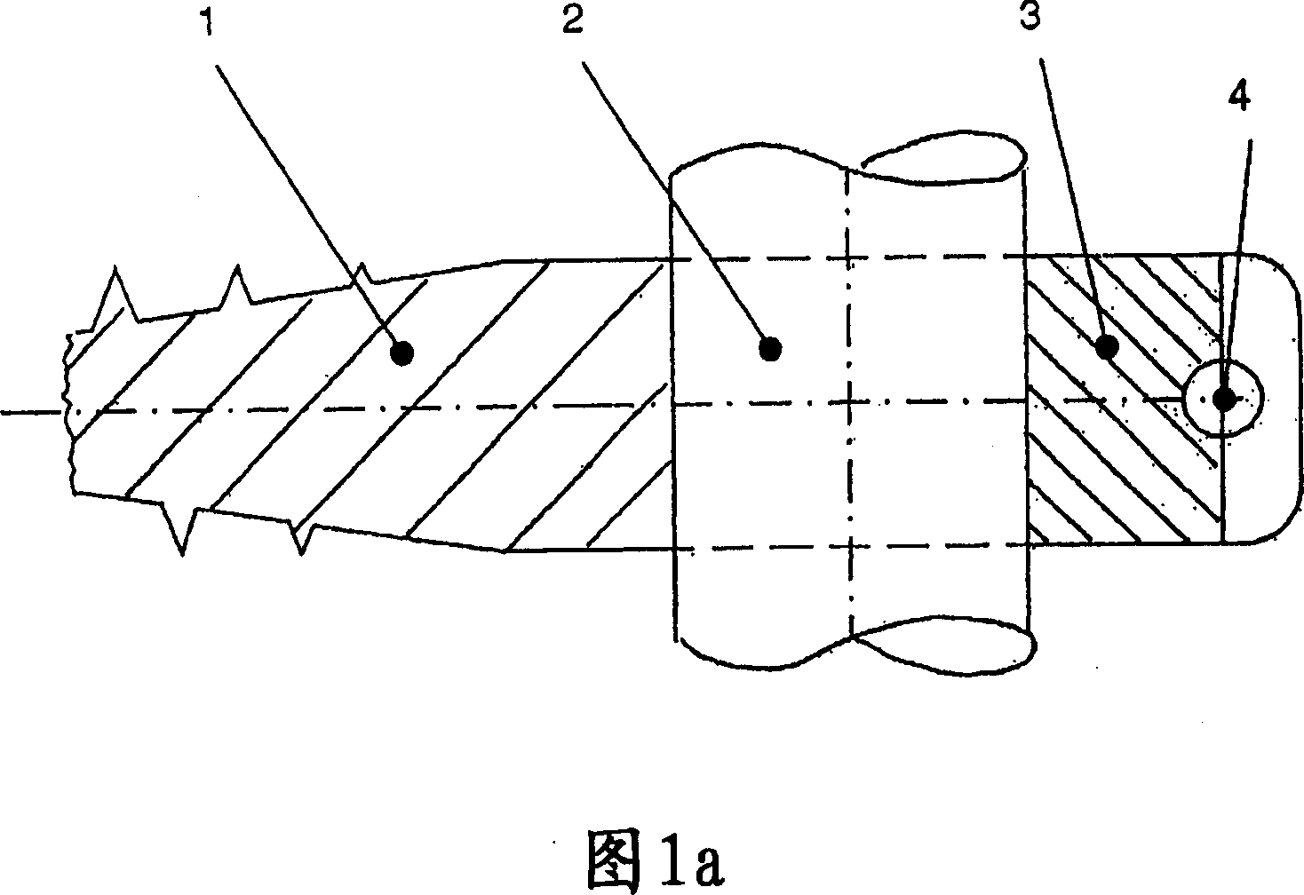 Dynamic clamping device for spinal implant