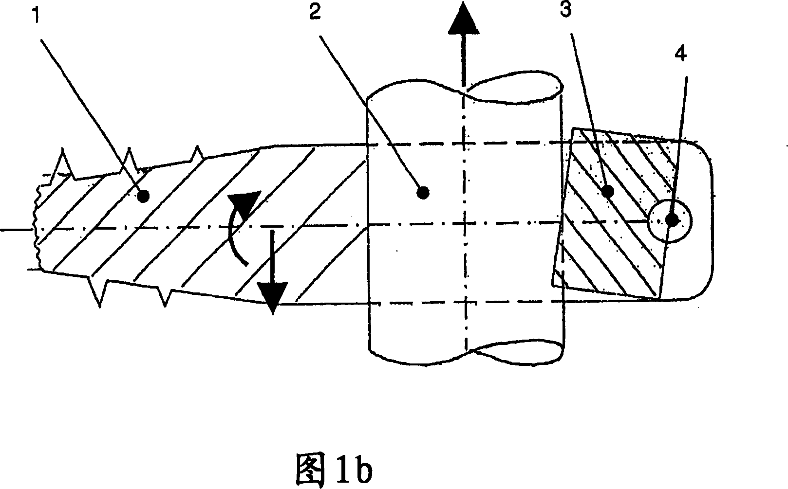 Dynamic clamping device for spinal implant