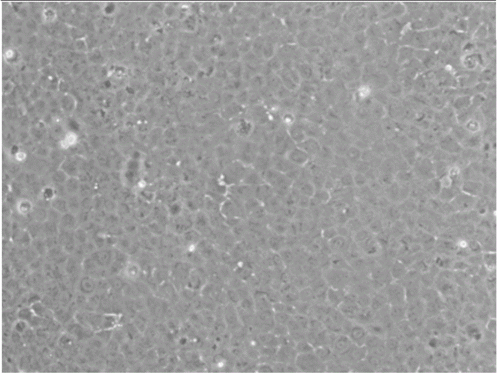 A separation culture method for lens epithelium stem cells