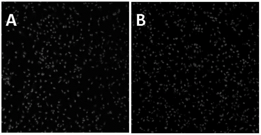 A separation culture method for lens epithelium stem cells