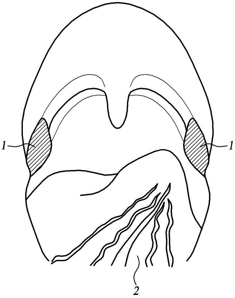 Ultrasonic probe