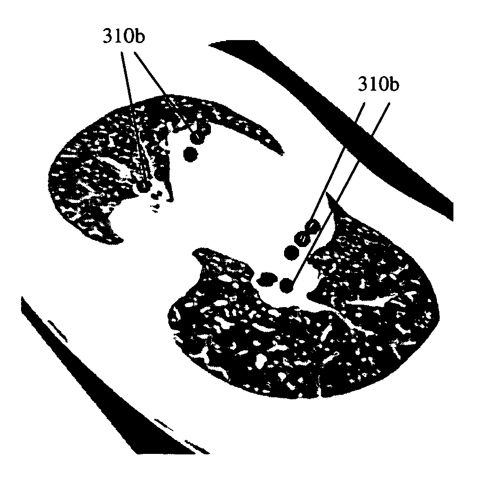 System and method for 3D visualization of lung perfusion or density and statistical analysis thereof