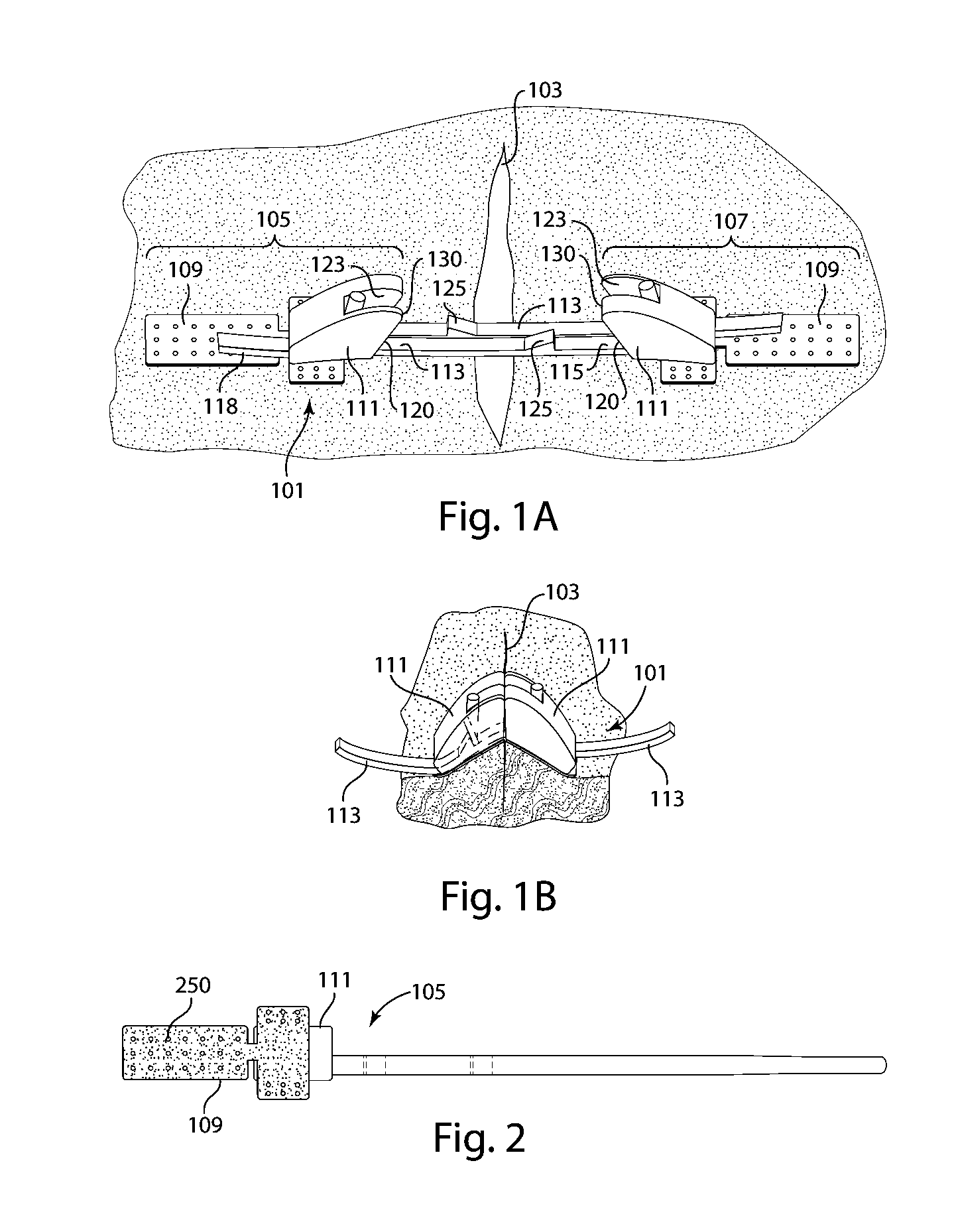 Devices for Securely Closing Tissue Openings with Minimized Scarring