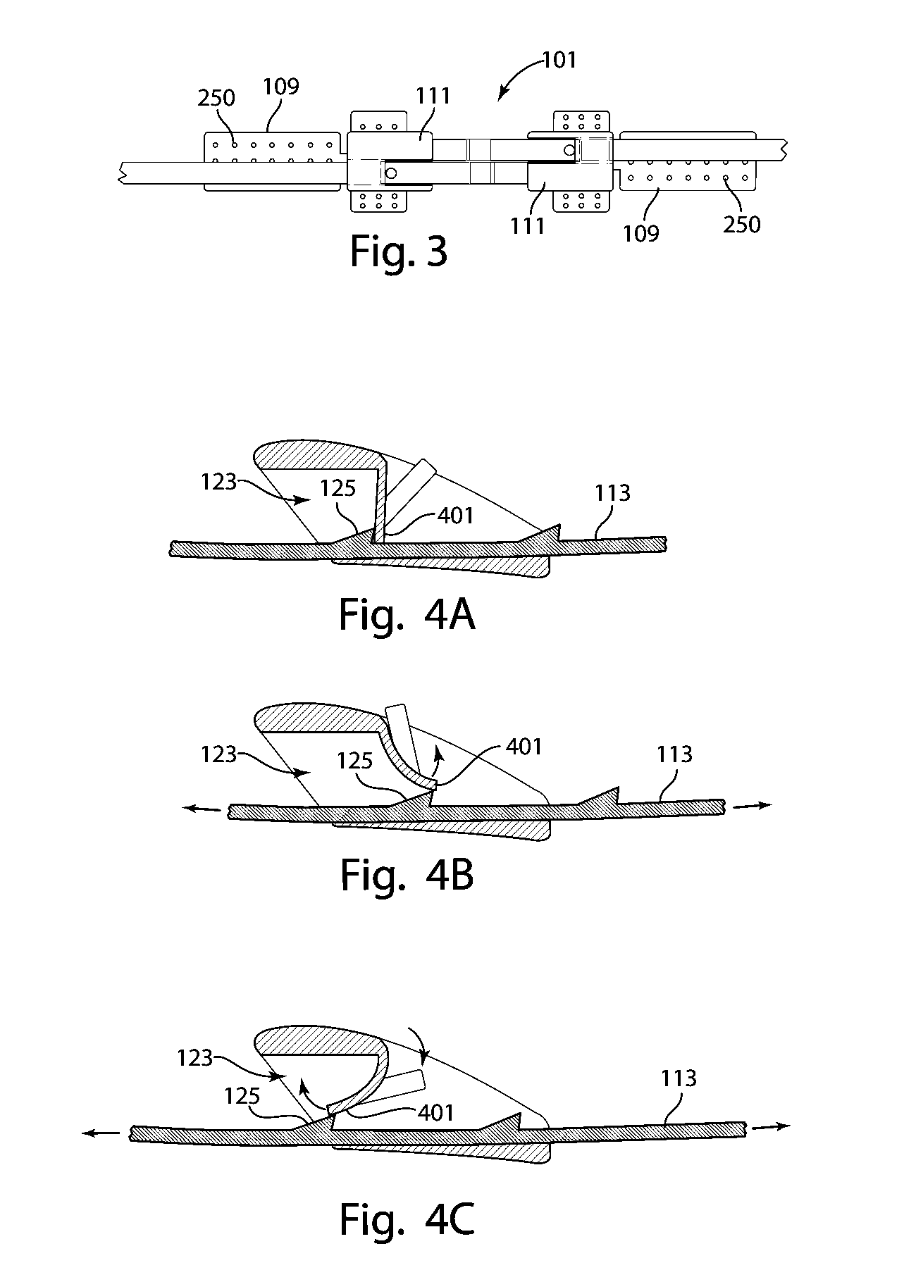 Devices for Securely Closing Tissue Openings with Minimized Scarring