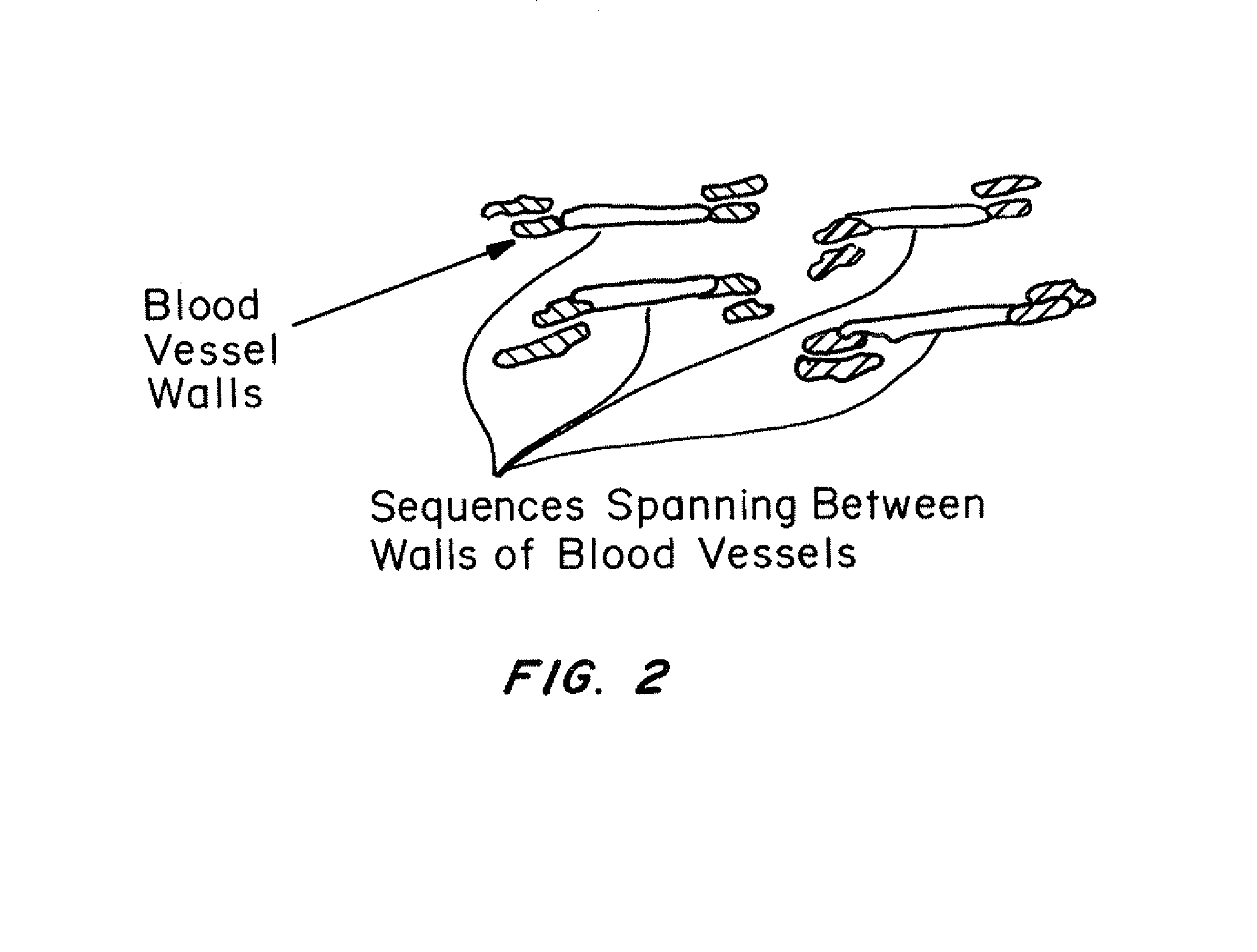 Treatment of leaky or damaged tight junctions and enhancing extracellular matrix