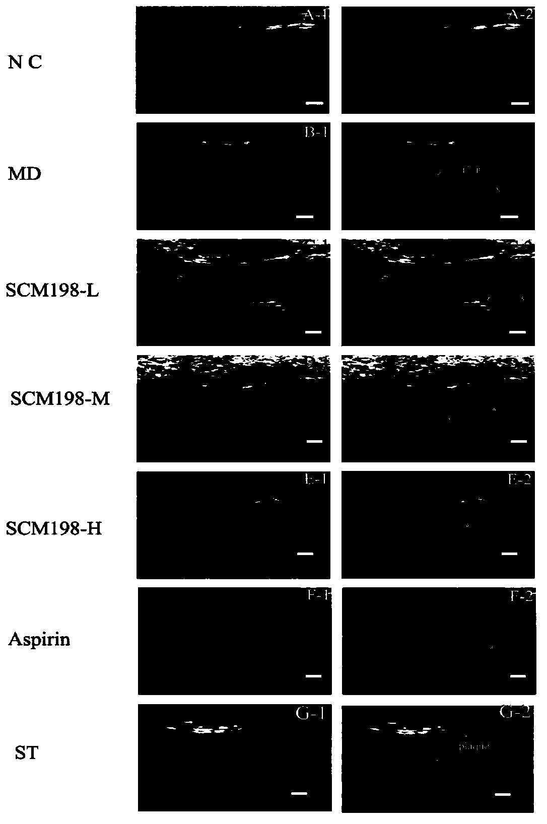 Applications of leonurine in preparation of medicines used for treating atherosclerosis