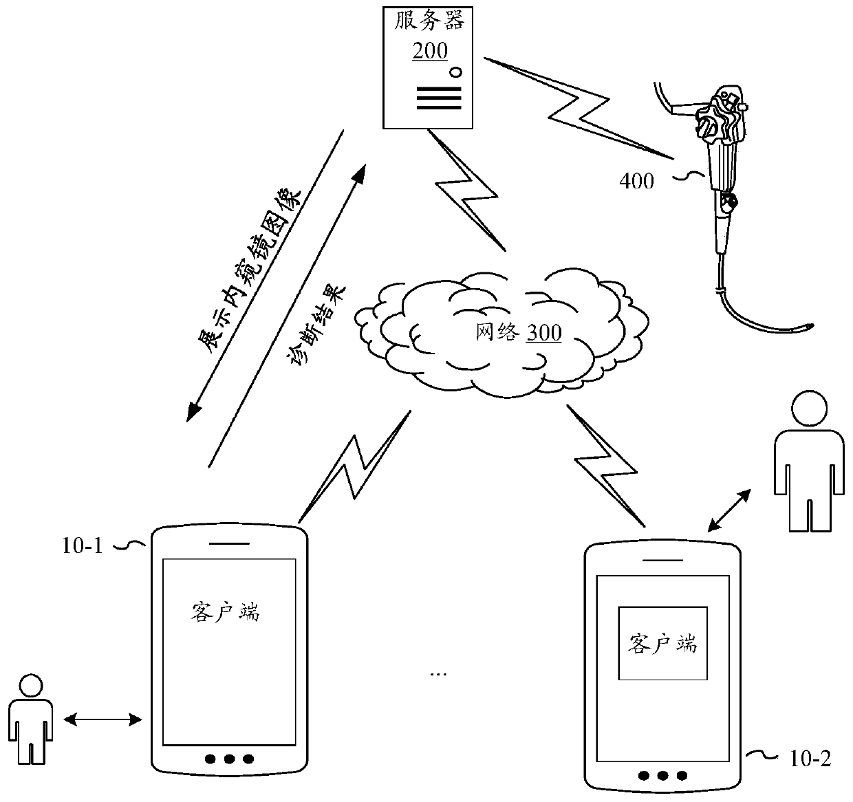 Endoscope image processing method and device, electronic equipment and storage medium