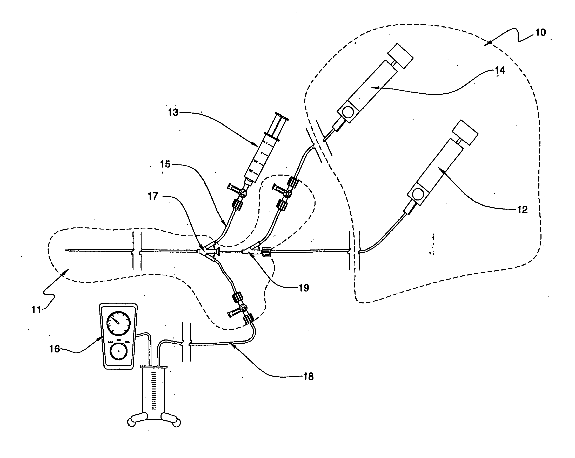 Fluid delivery systems for delivering fluids to multi-lumen catheters