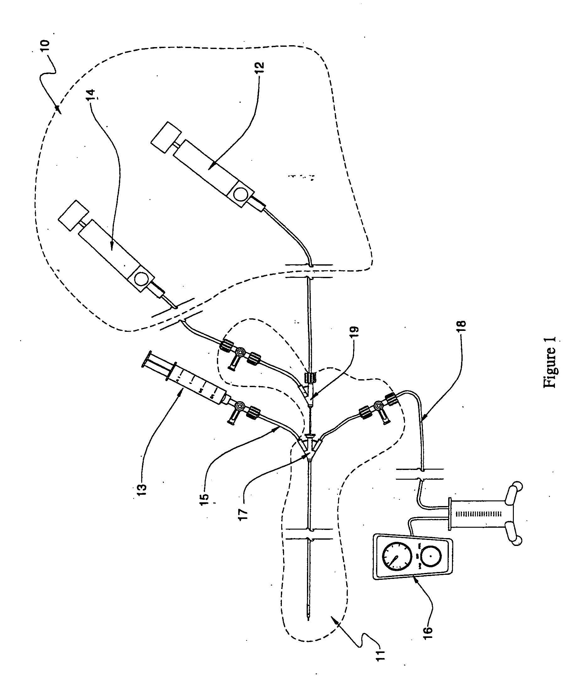 Fluid delivery systems for delivering fluids to multi-lumen catheters