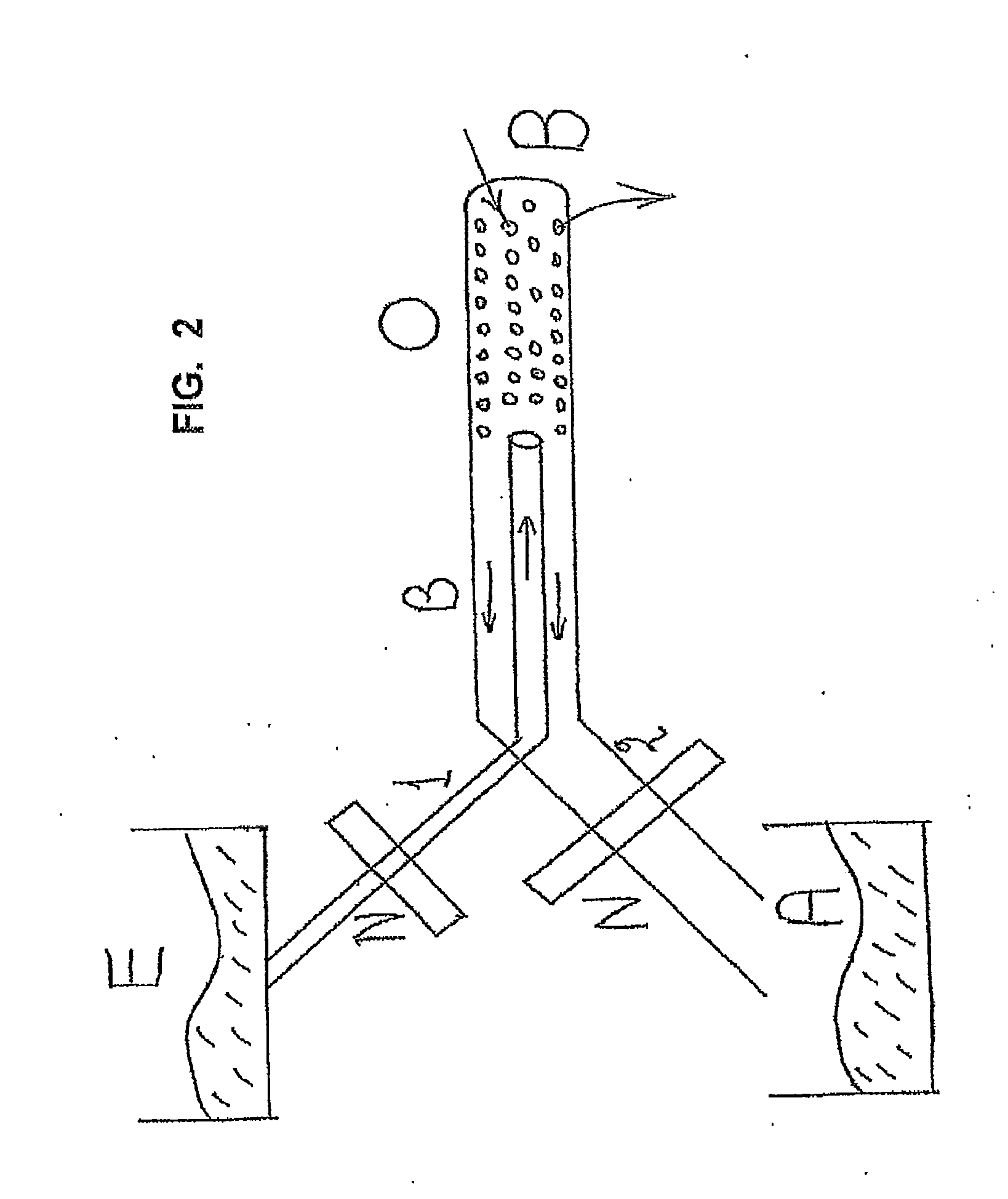 Fluid Exchange Catheter System