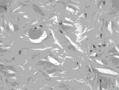 Preparing method of heterogeneous acellular dermal matrix substrate with good biocompatibility