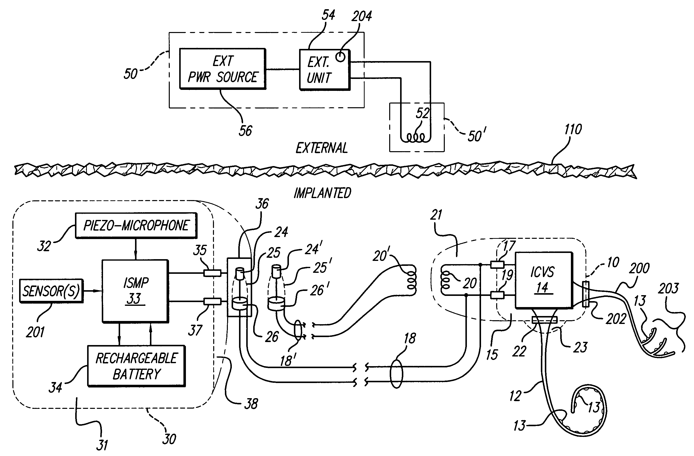 Dual cochlear/vestibular stimulator with control signals derived from motion and speech signals