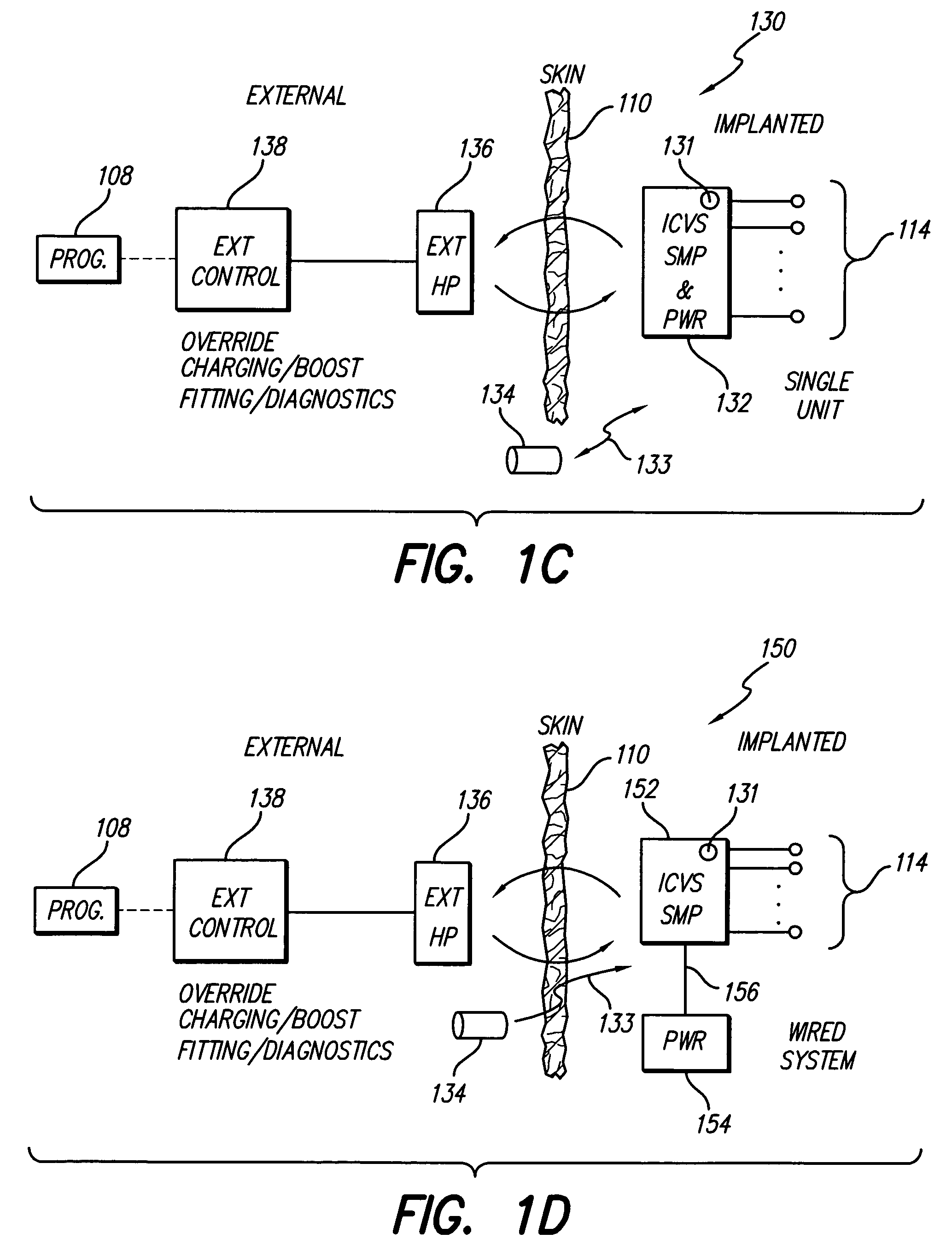 Dual cochlear/vestibular stimulator with control signals derived from motion and speech signals