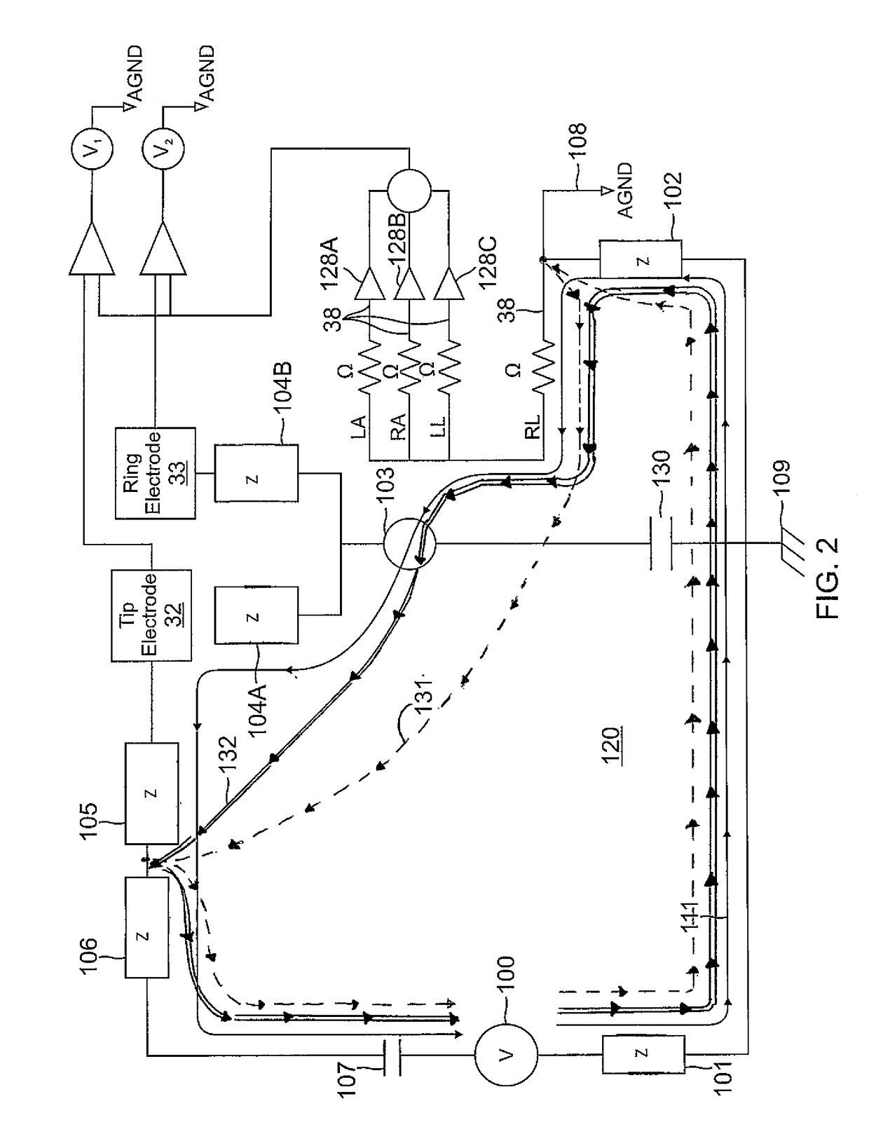 Electrocardiogram noise reduction