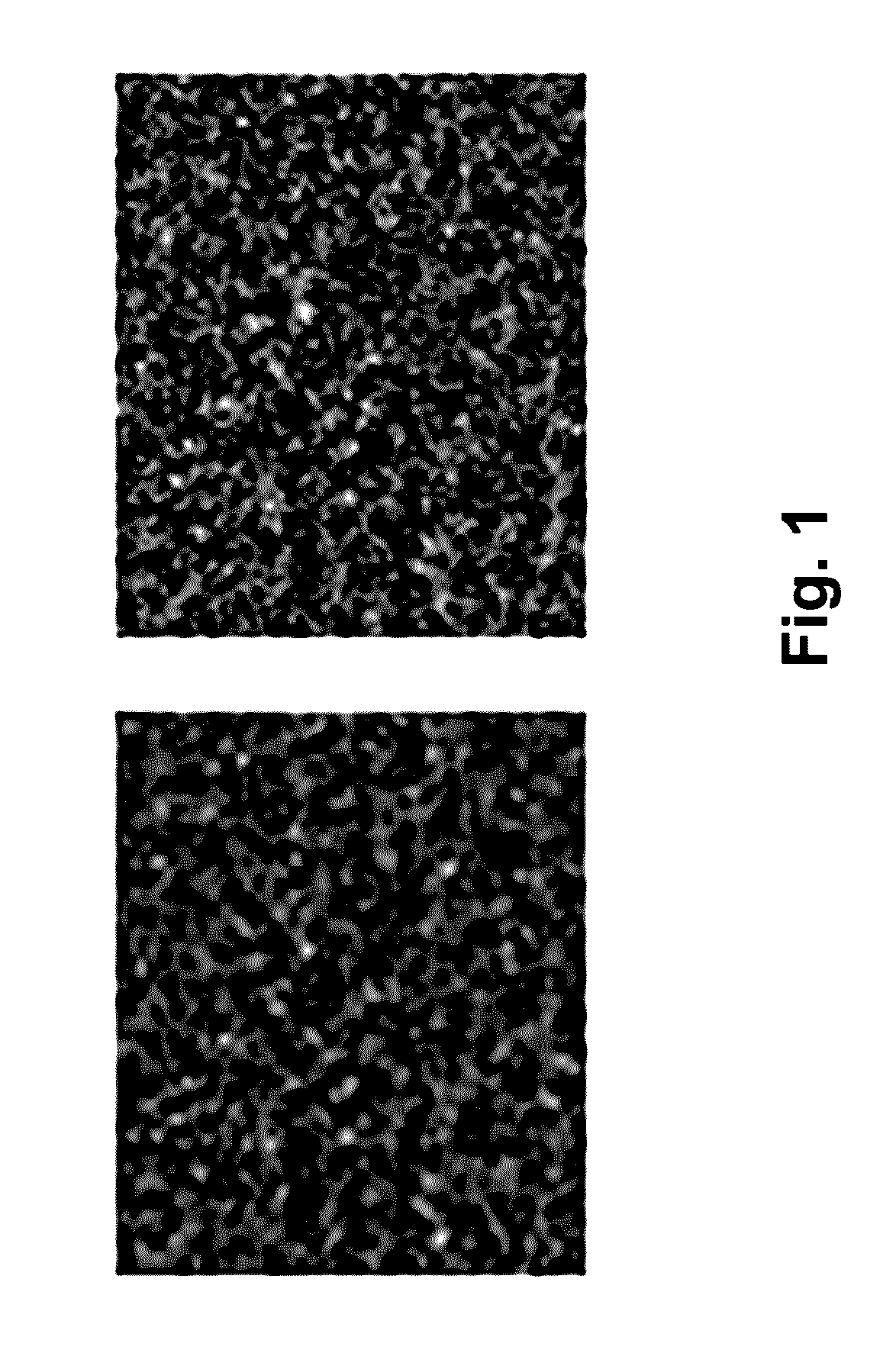 Time-space methods and systems for the reduction of video noise