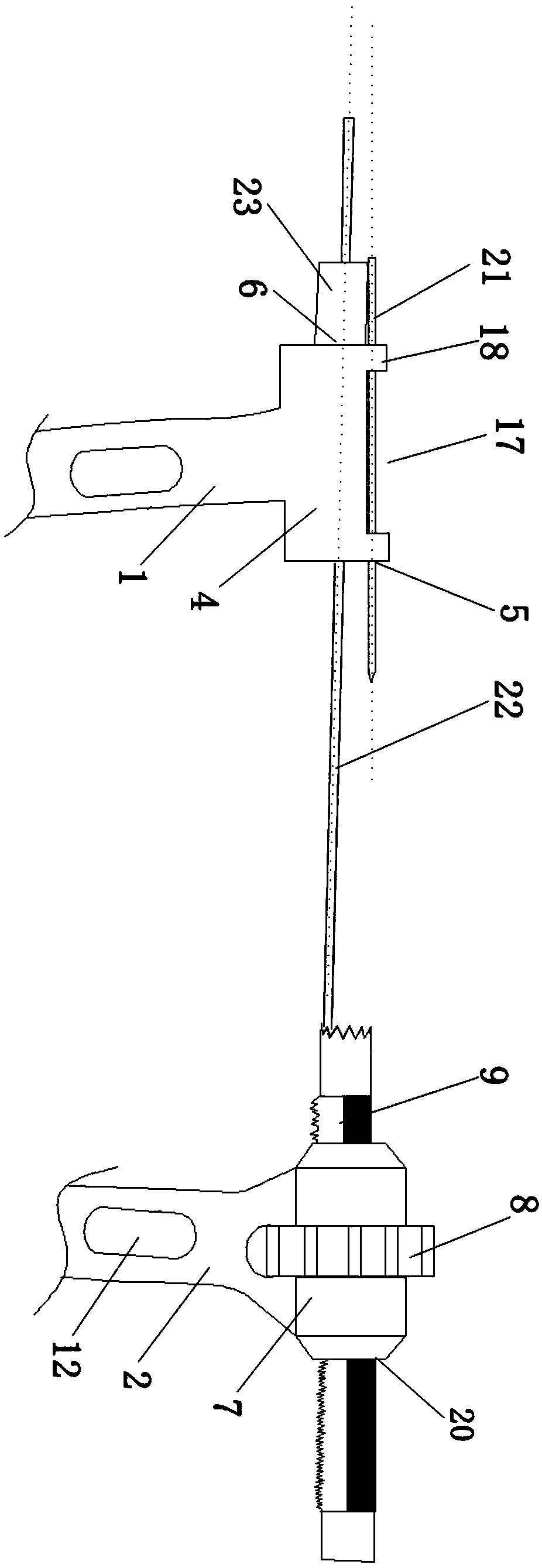 Calcaneal sustentaculum tali guide and using method thereof