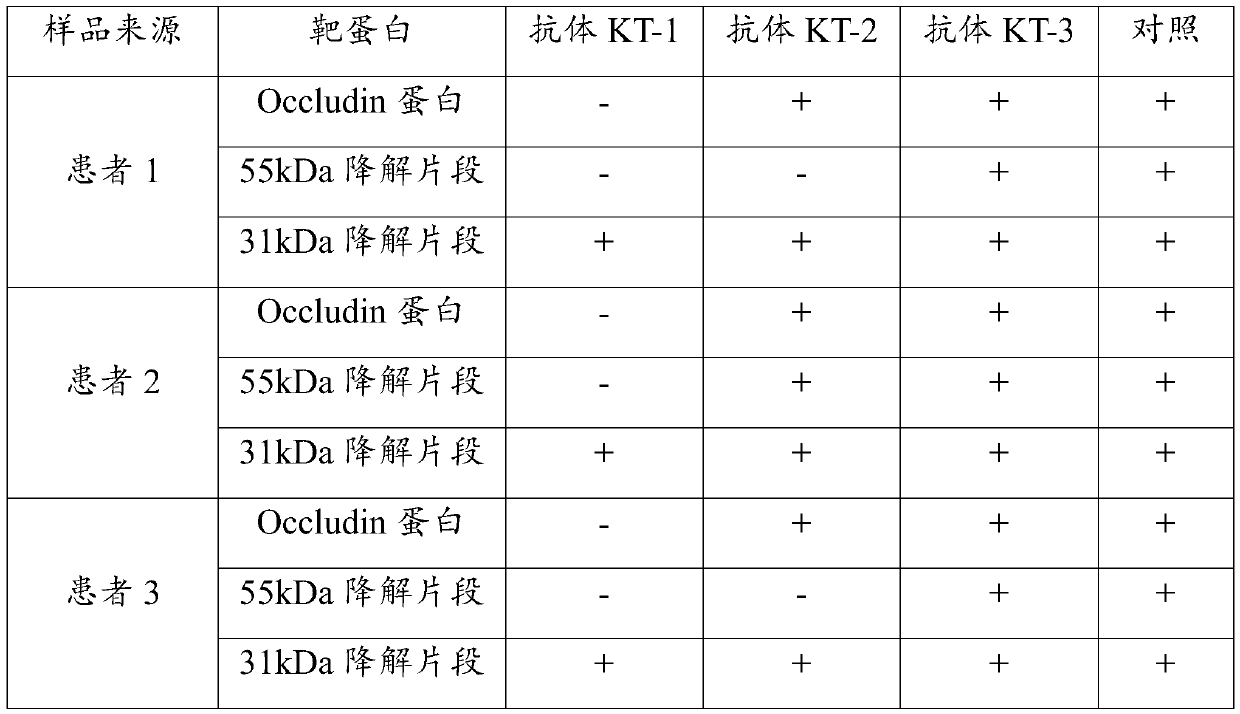 Specific epitope peptide of occludin 31kDa degradation fragment and application of specific epitope peptide