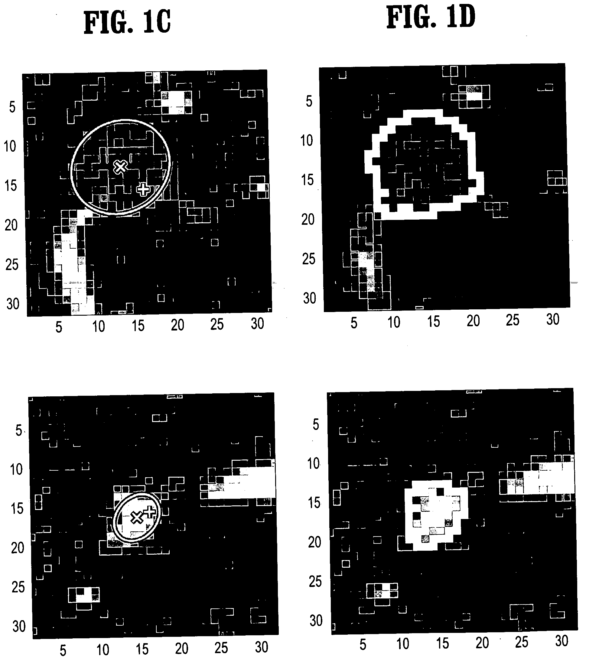 3D segmentation of targets in multislice image