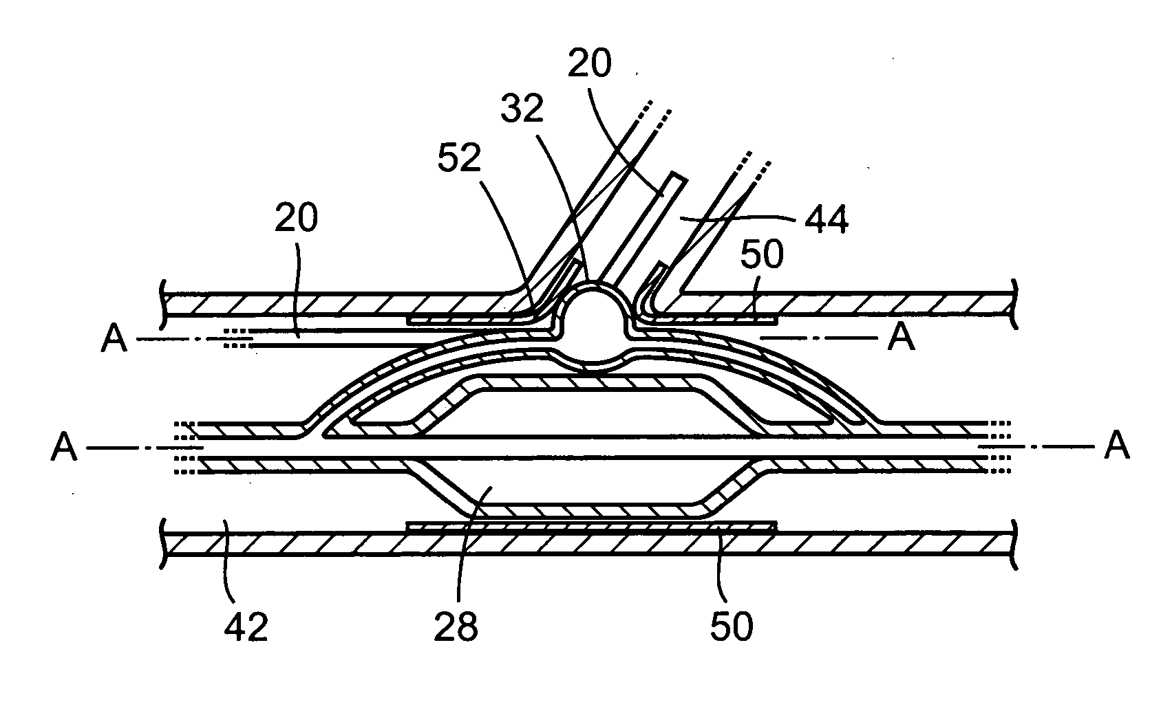 Catheter balloon systems and methods