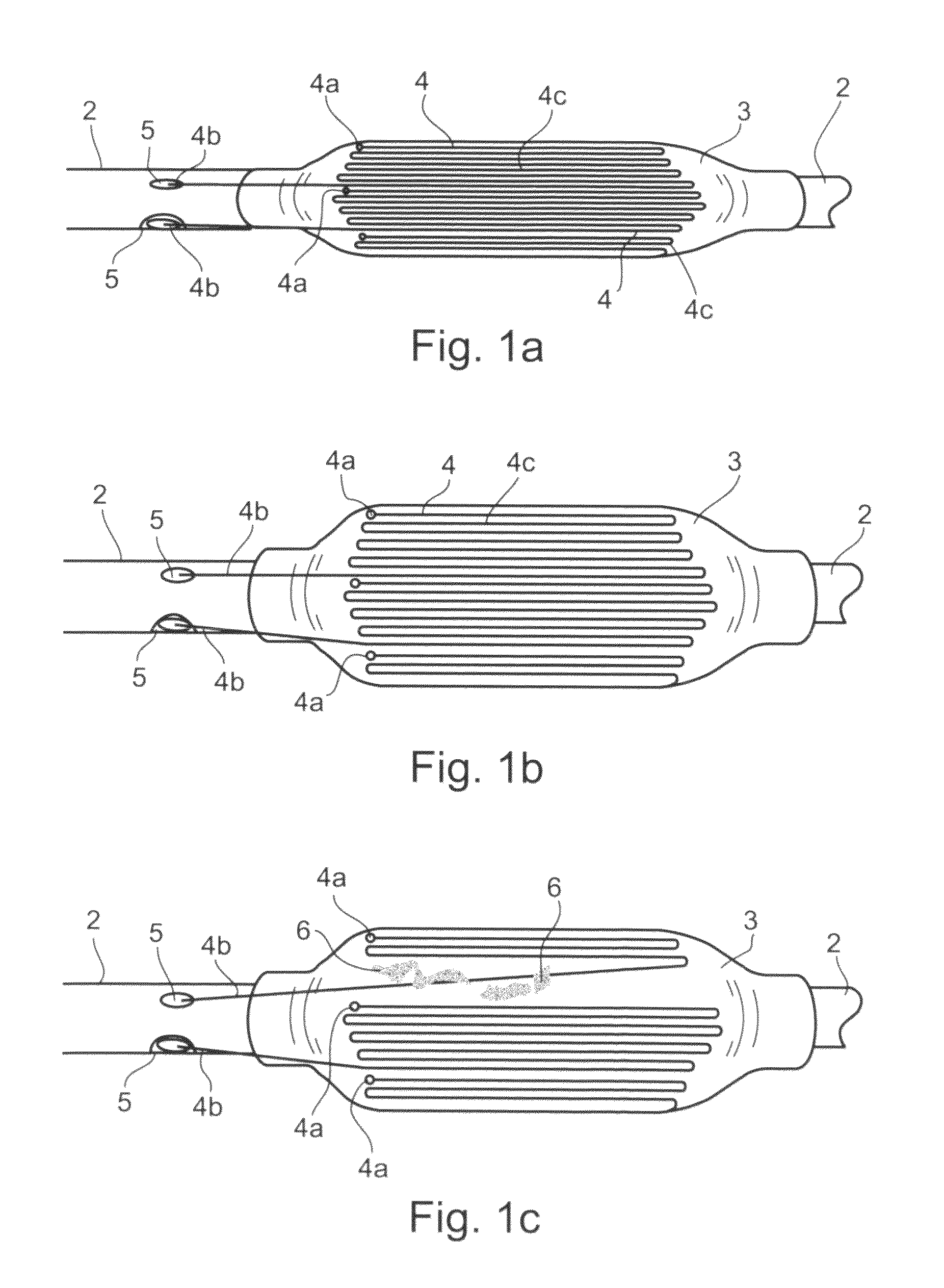 Apparatus and method for removing deposits from tubular structure, particularly atheroma from blood vessels