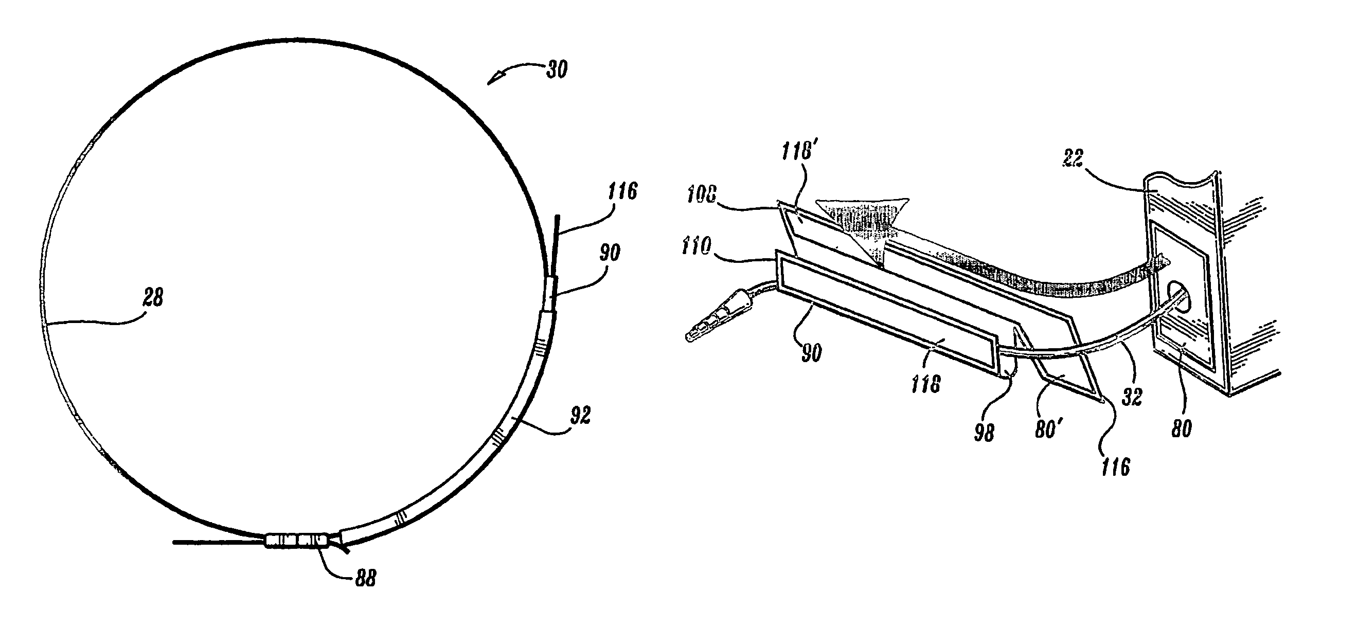 Portable enteral feeding apparatus