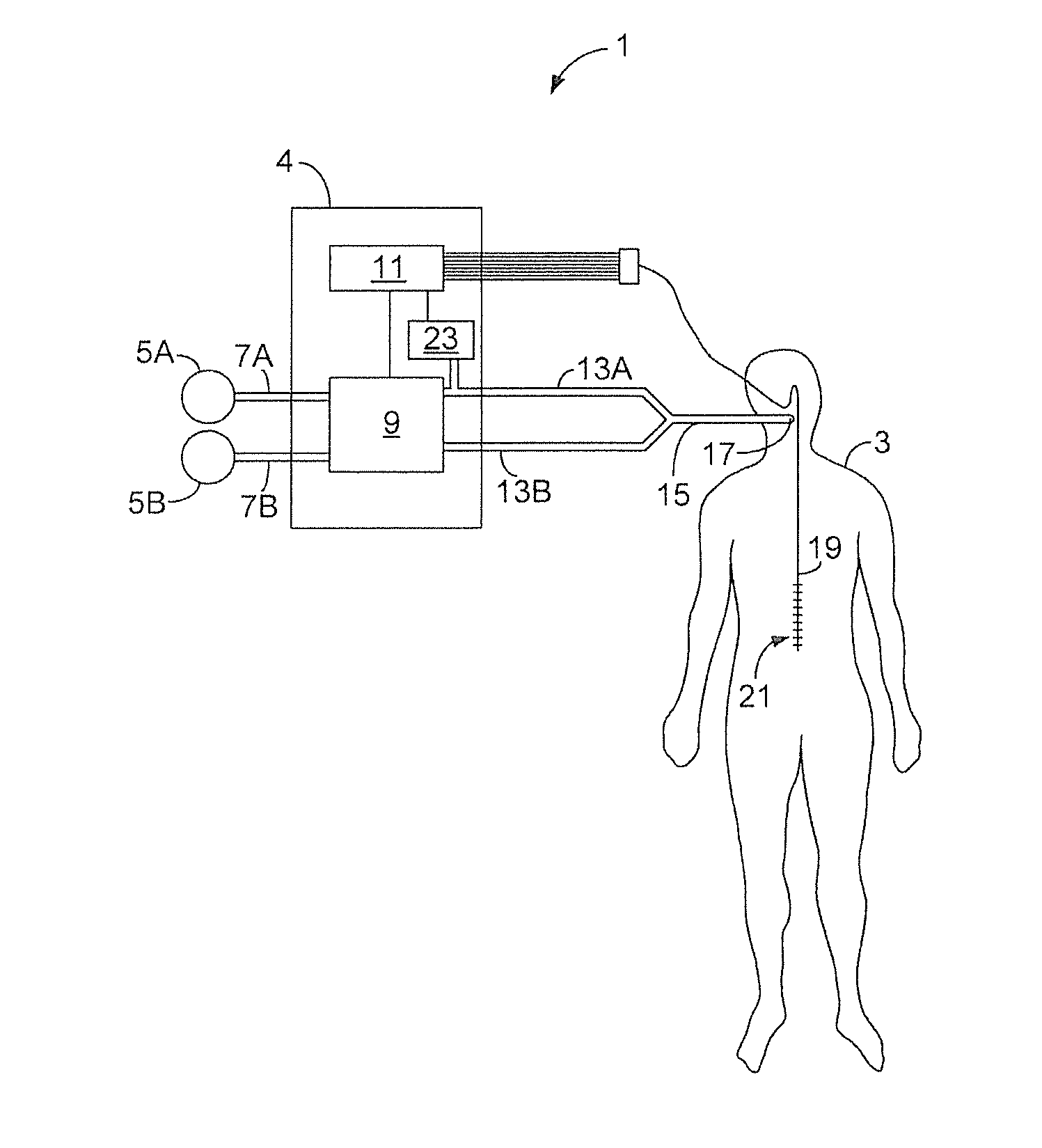 Neurally triggered support ventilation during hfo ventilation