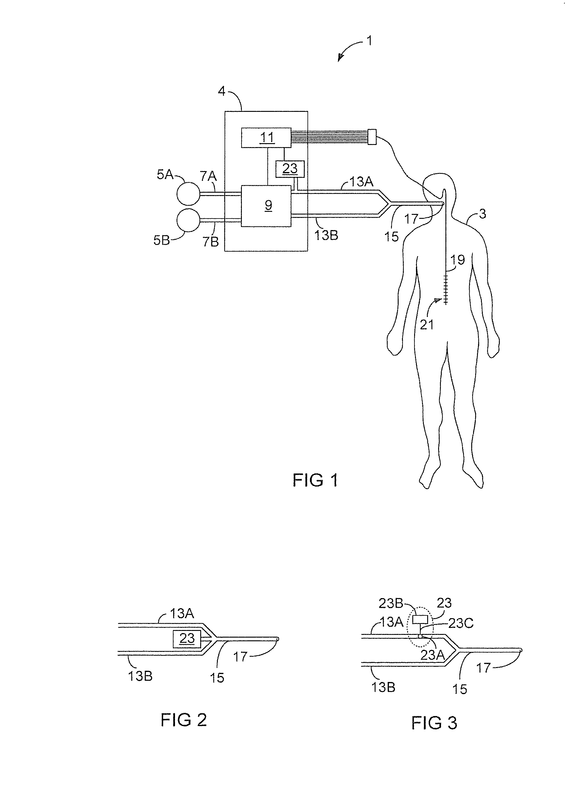 Neurally triggered support ventilation during hfo ventilation