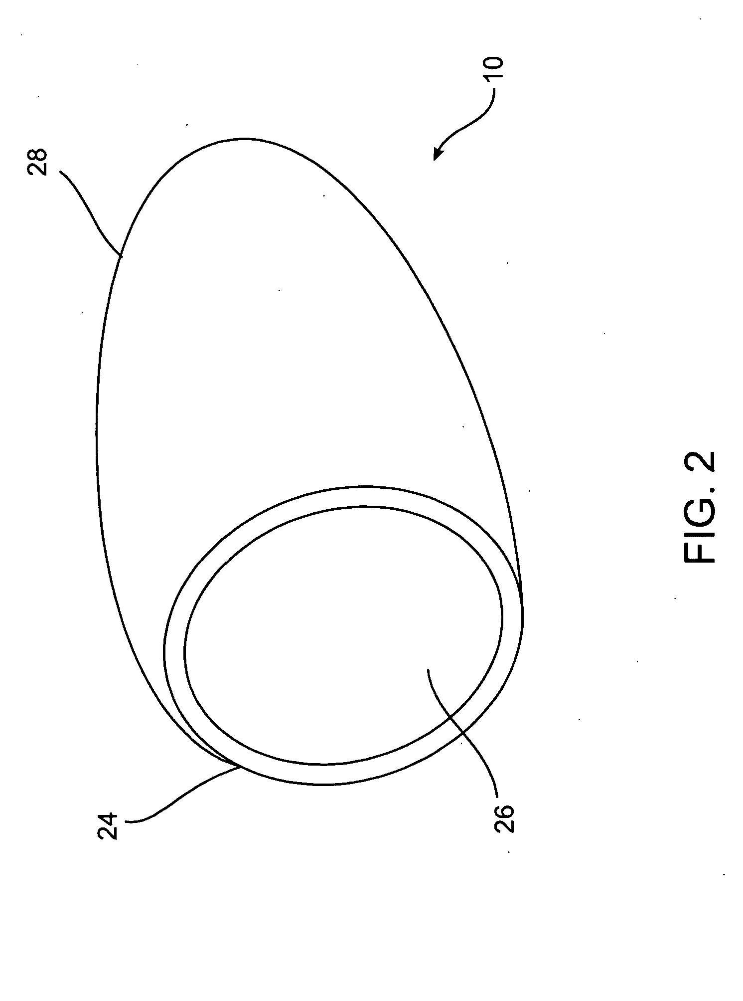 Sizing and shaping device for treating congestive heart failure