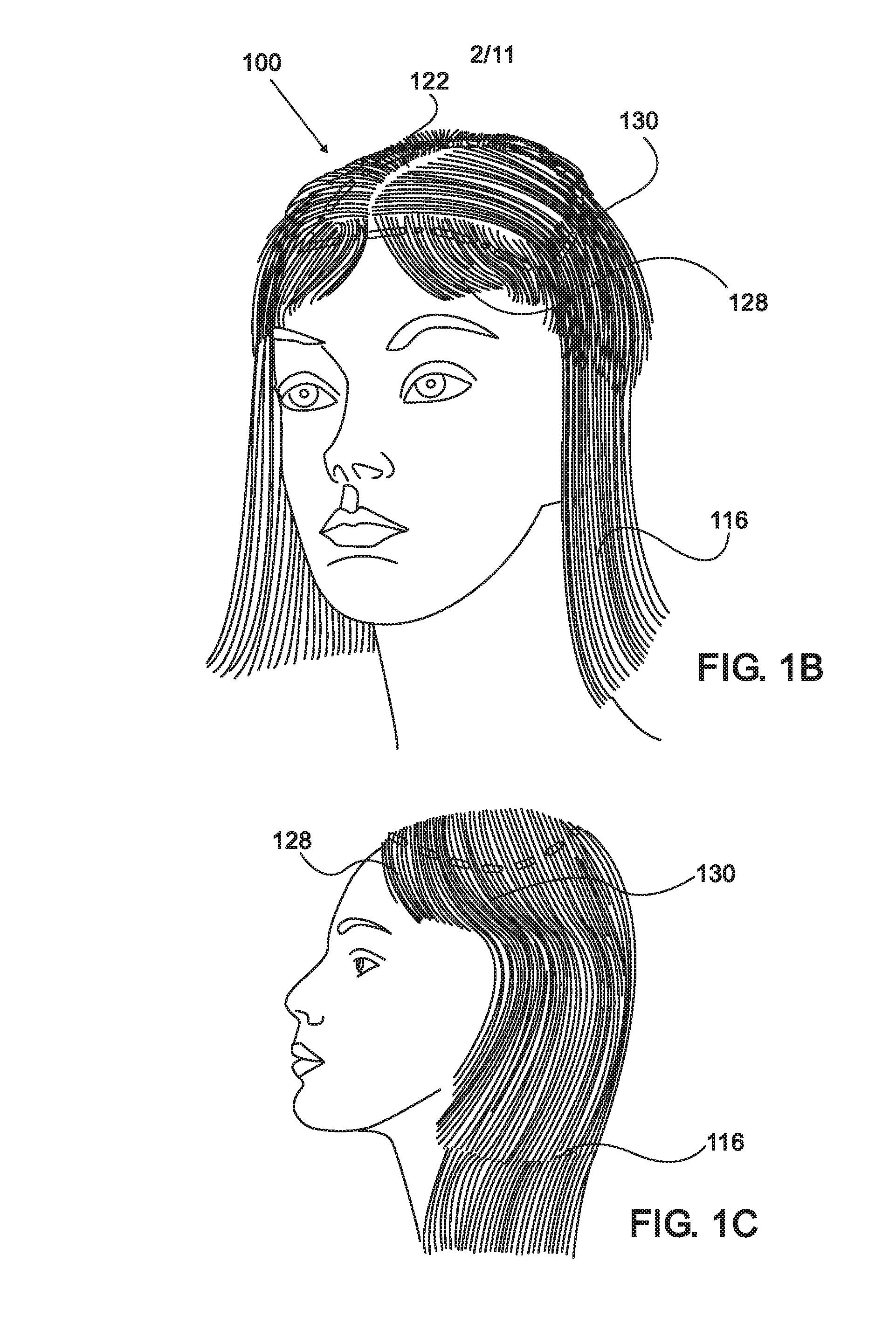 Detachable wig arrangement and method