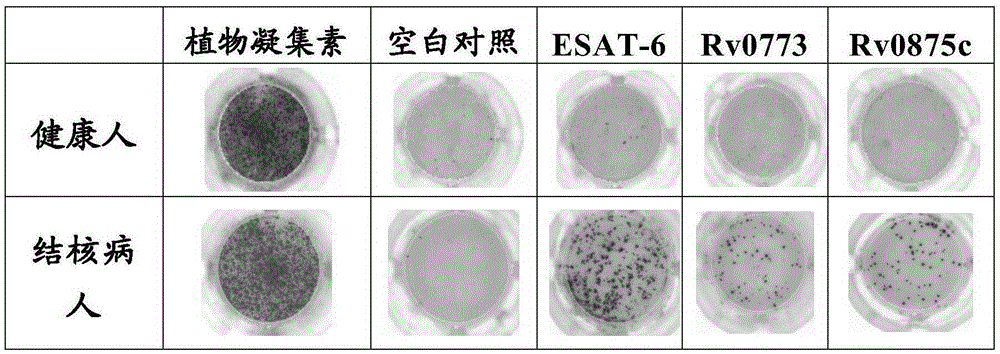 Tuberculosis immunodiagnosis molecular marker and vaccine use thereof