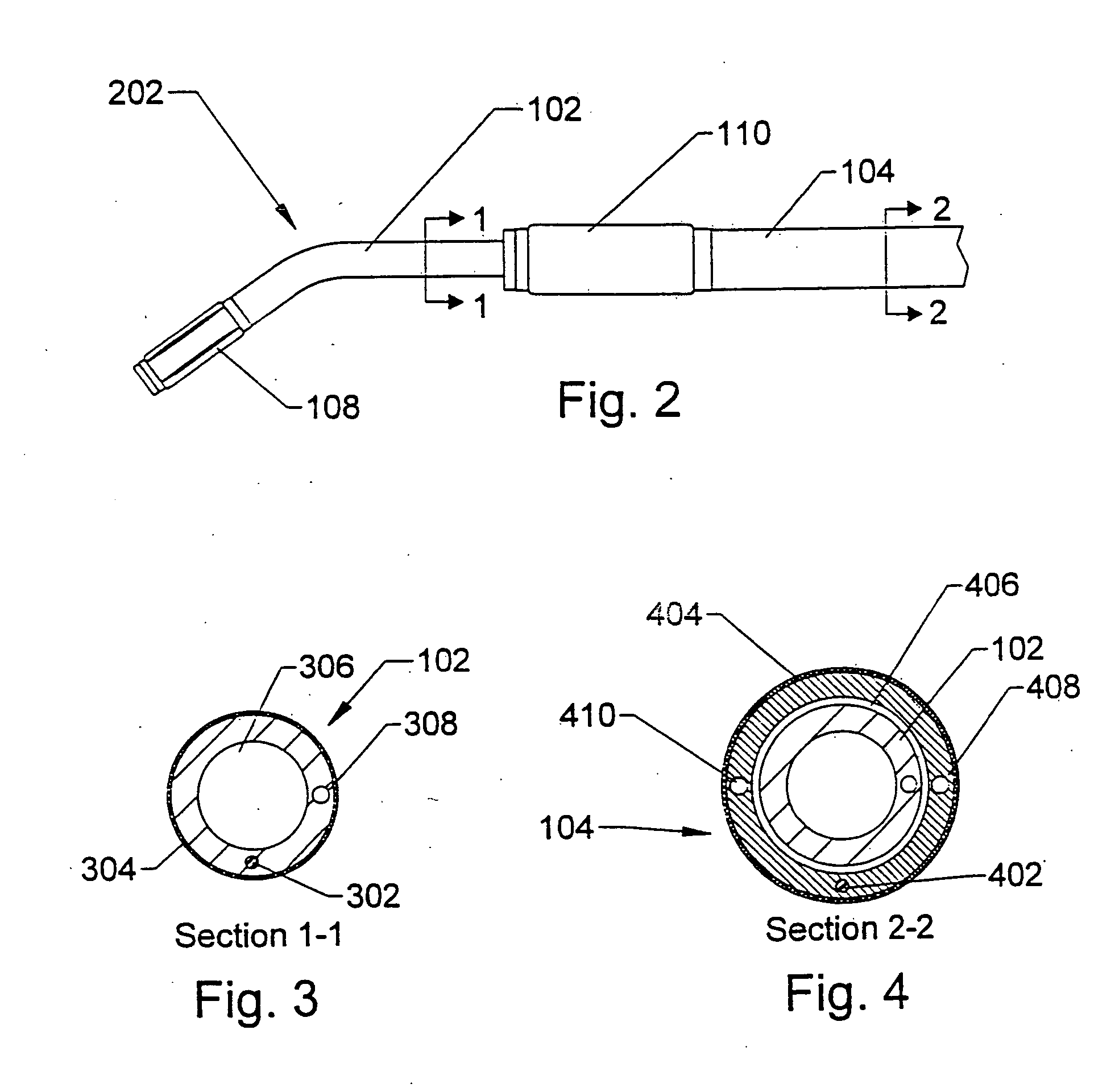 Methods using a dual balloon telescoping guiding catheter