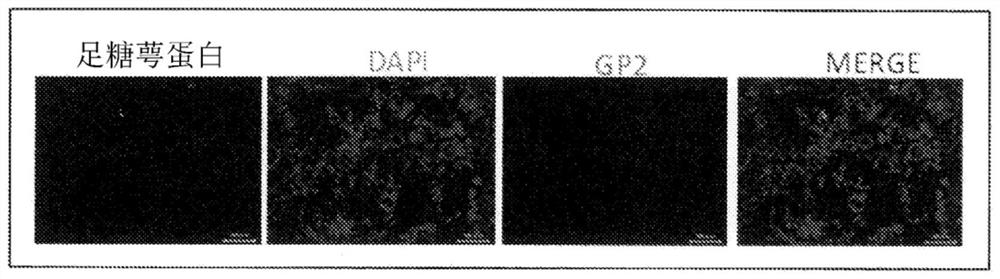 Transmucosal administration of agents