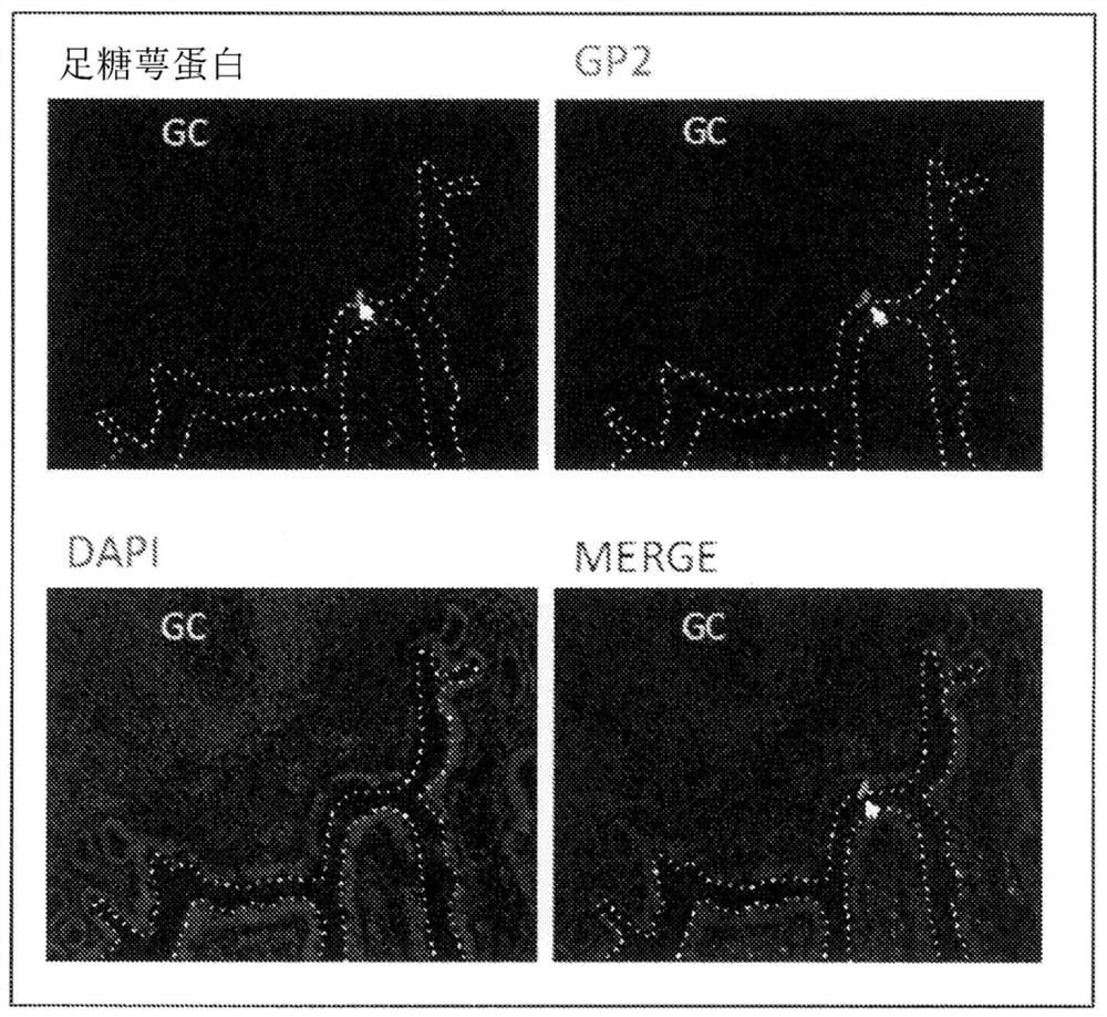 Transmucosal administration of agents