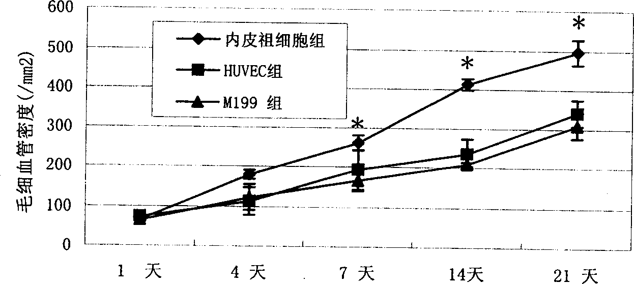 Stem cell prepn for treating tissue ischemia disease and its prepn process