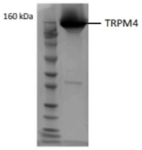 Drug target expression and purification method for high blood pressure