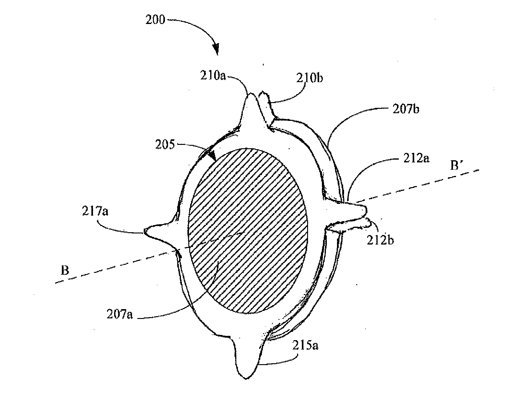 Micro-incision iol and positioning of the iol in the eye