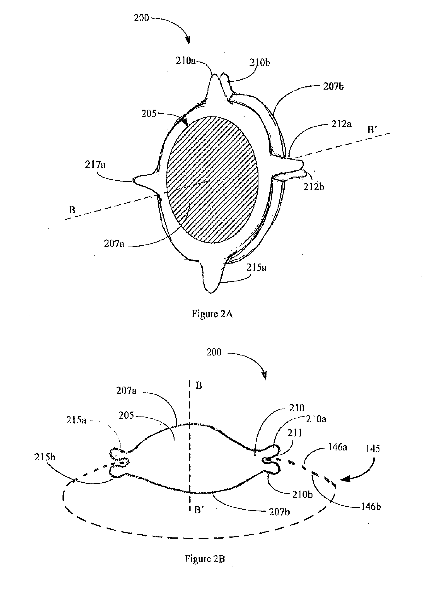 Micro-incision iol and positioning of the iol in the eye