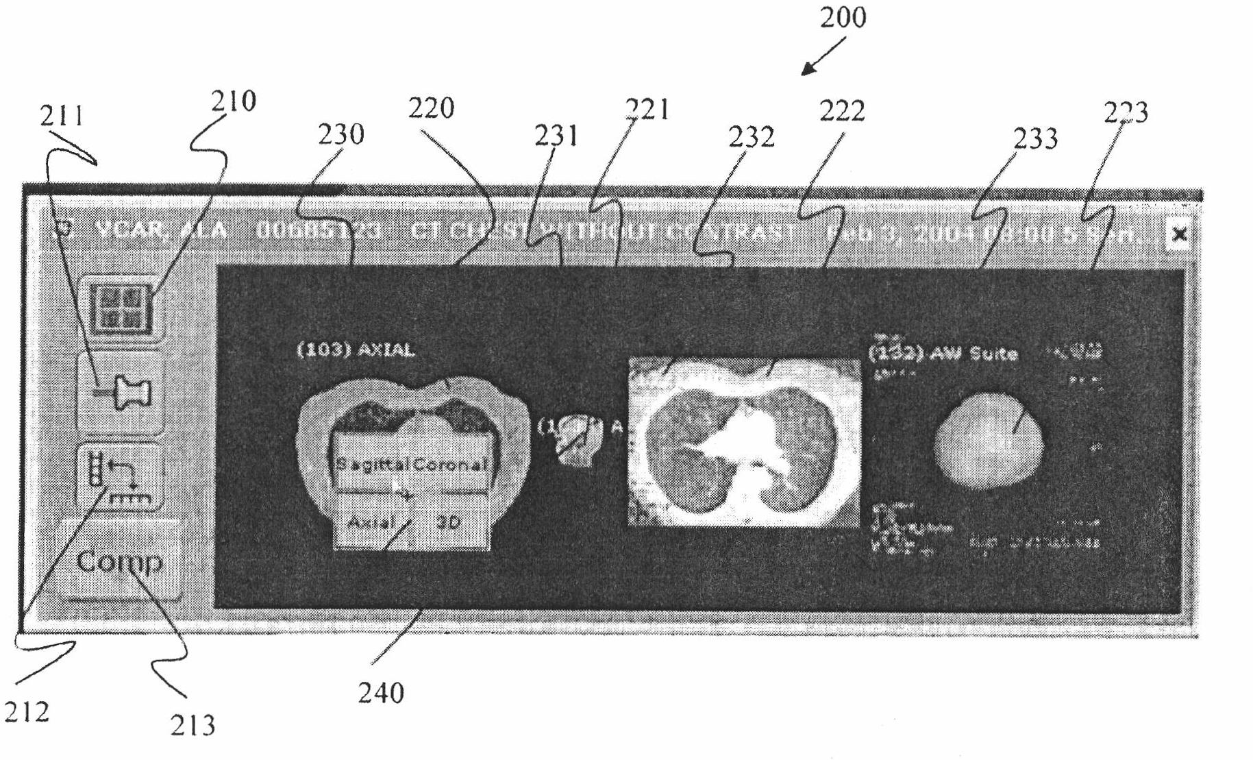 Systems and methods for applying series level operations and comparing images using a thumbnail navigator