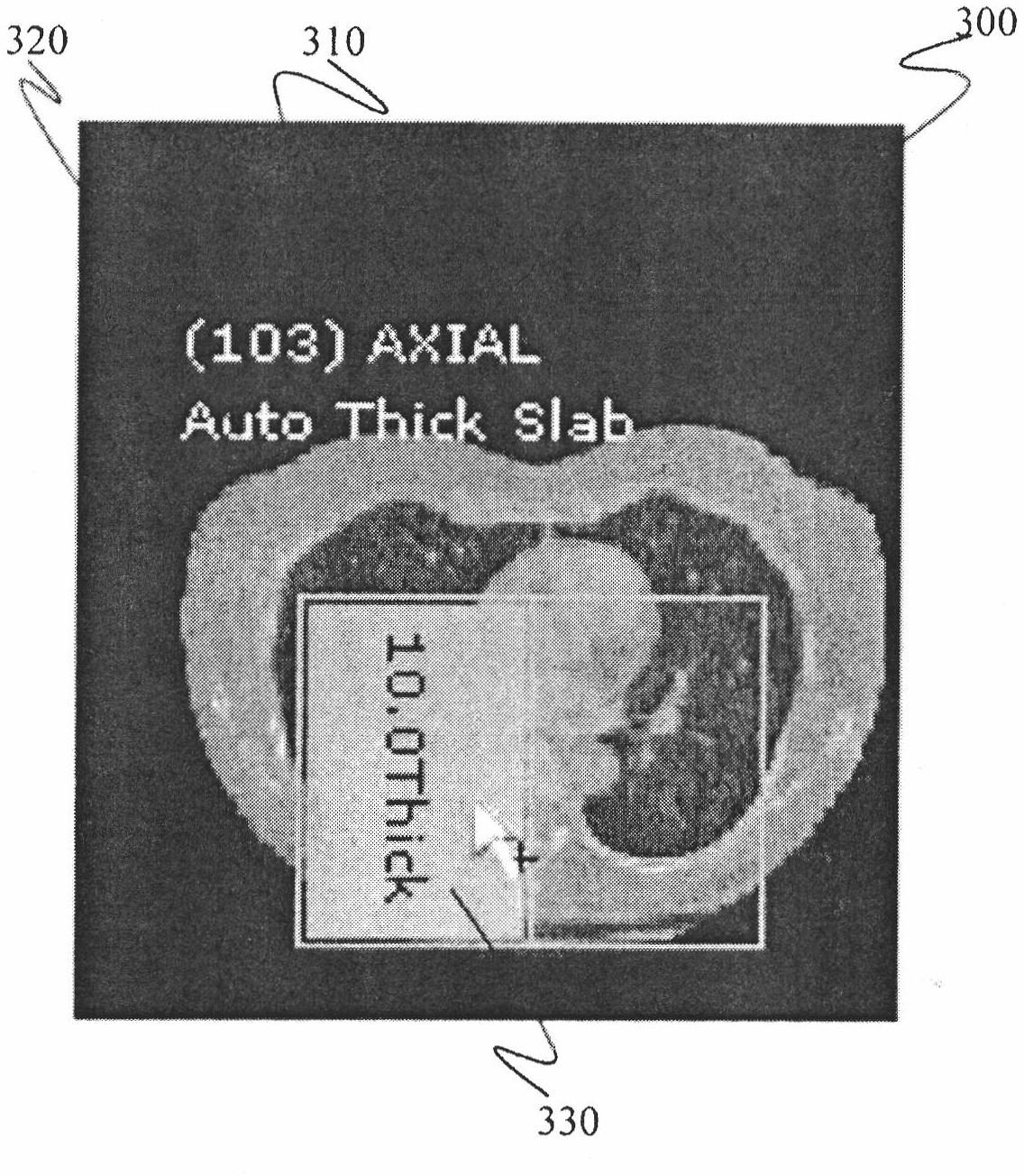 Systems and methods for applying series level operations and comparing images using a thumbnail navigator