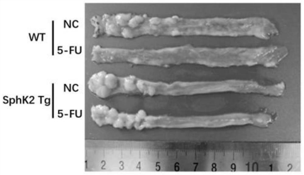 A kind of pharmaceutical composition for treating digestive tract cancer