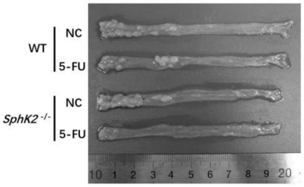 A kind of pharmaceutical composition for treating digestive tract cancer