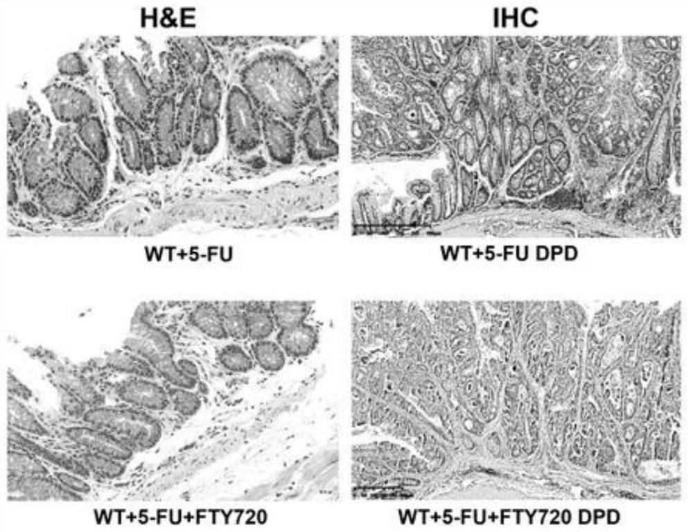 A kind of pharmaceutical composition for treating digestive tract cancer